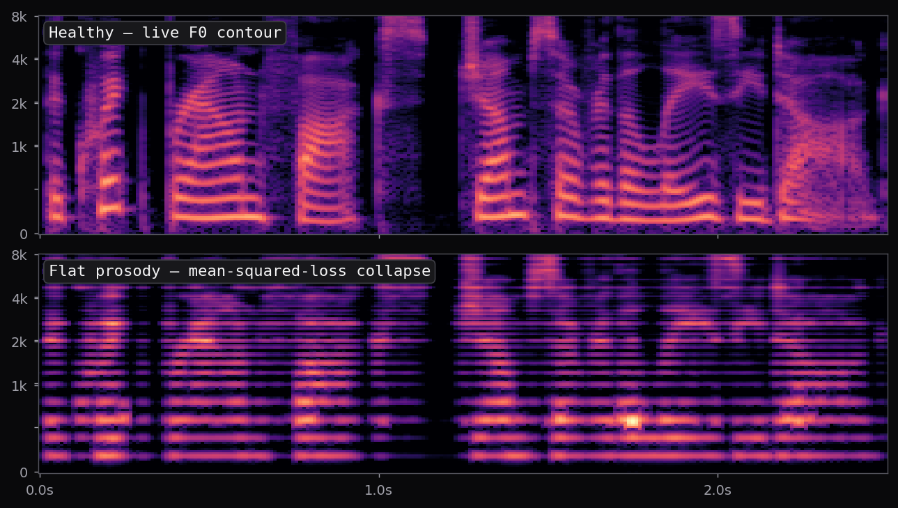 Mel spectrogram: healthy live F0 contour on top with curving harmonic stack; flat-prosody collapse on bottom with perfectly horizontal harmonic stripes at a single F0.