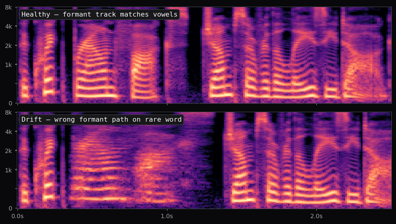 Mel spectrogram: healthy formant track matching expected vowels on top; pronunciation drift with wrong formant path and shifted pitch in a middle segment on bottom.